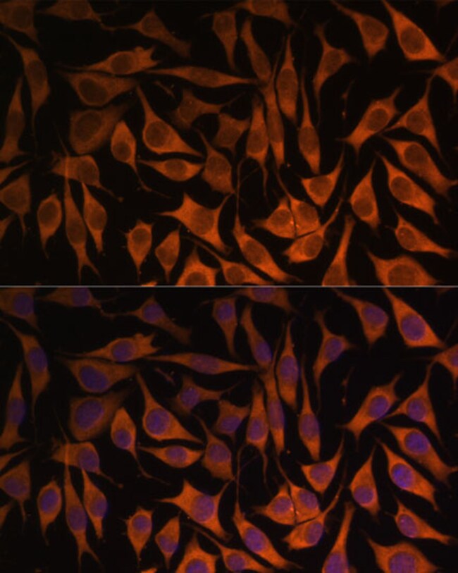 100UL MRPS35 ANTIBODY 100 ul