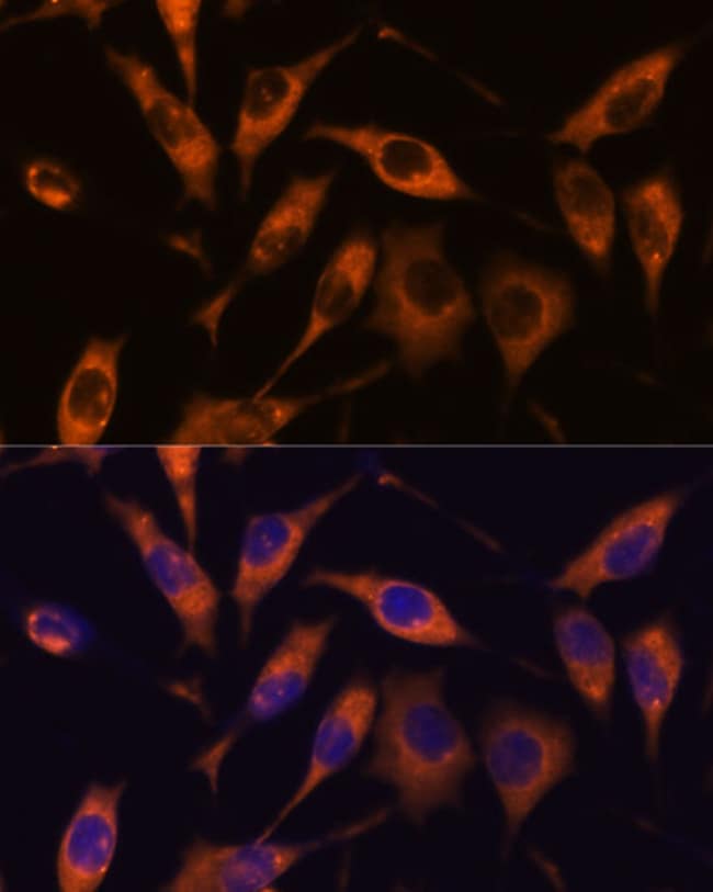 100UL ATL2 ANTIBODY 100 ul