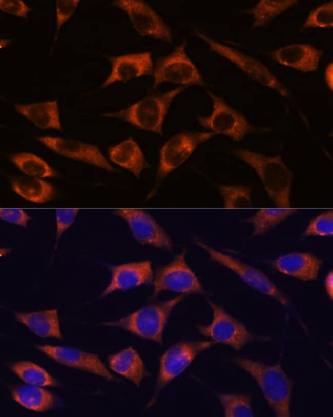100UL MMP25 ANTIBODY 100 ul