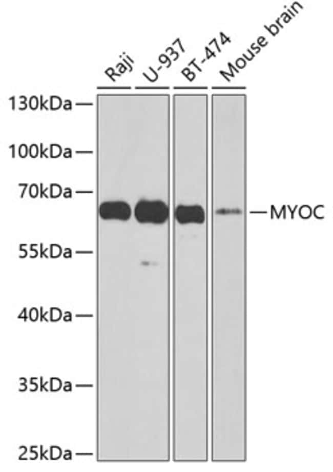 100UL MYOC ANTIBODY 100 ul