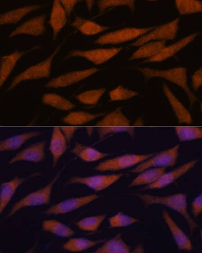 100UL DDX31 ANTIBODY 100 ul