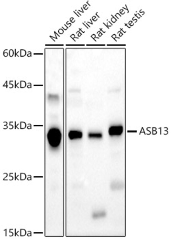 100UL ASB13 ANTIBODY 100 ul