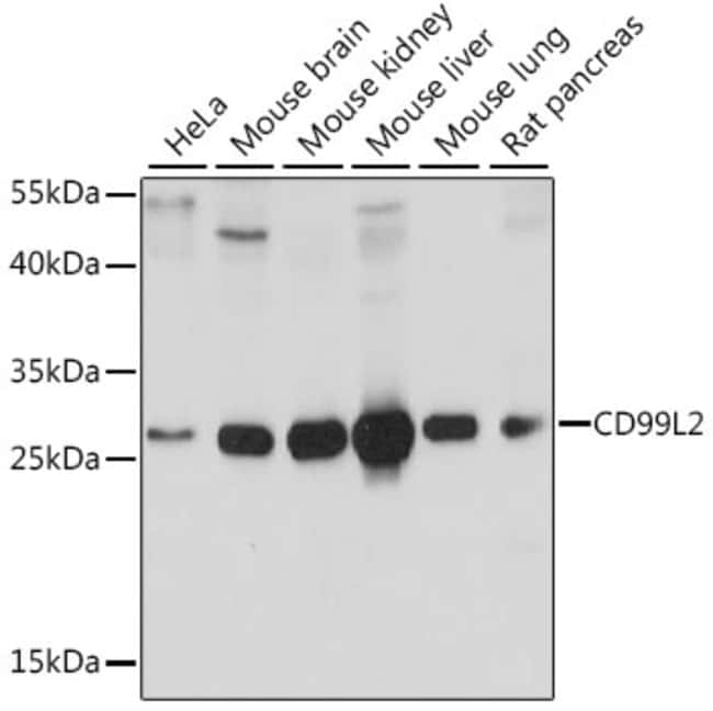 100UL CD99L2 ANTIBODY 100 ul