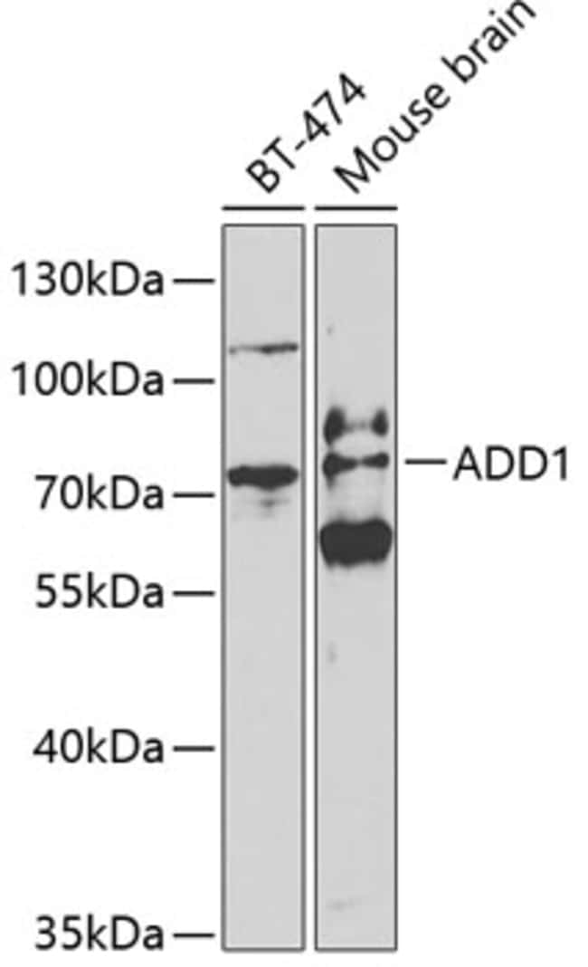 100UL ALPHA ADDUCIN ANTIBODY 100 ul