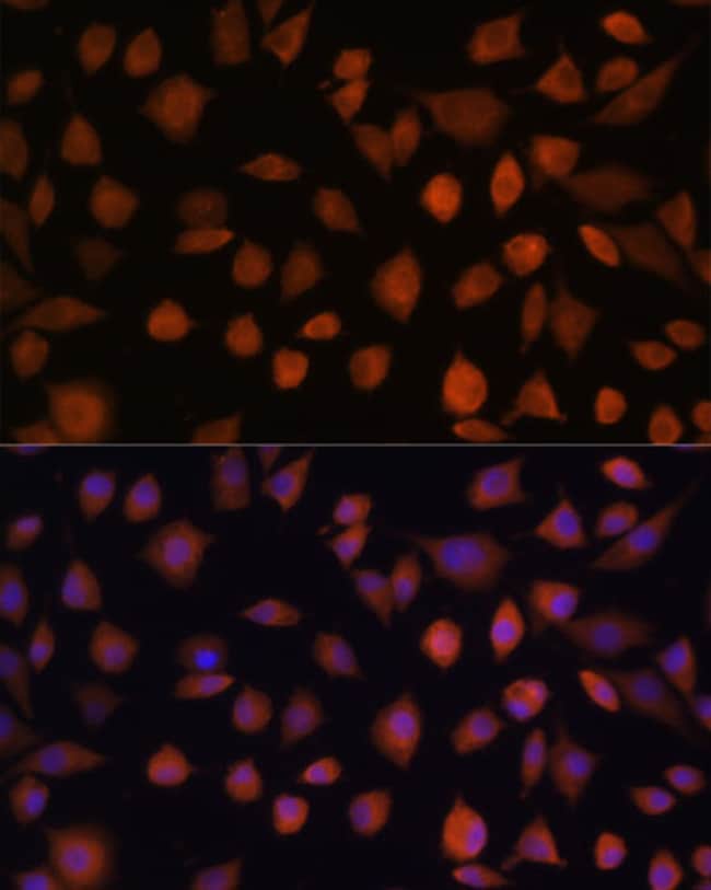 100UL ARMC6 ANTIBODY 100 ul