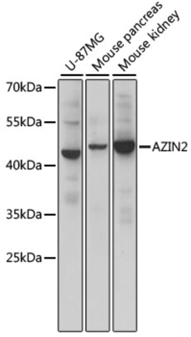 100UL ADC ANTIBODY 100 ul