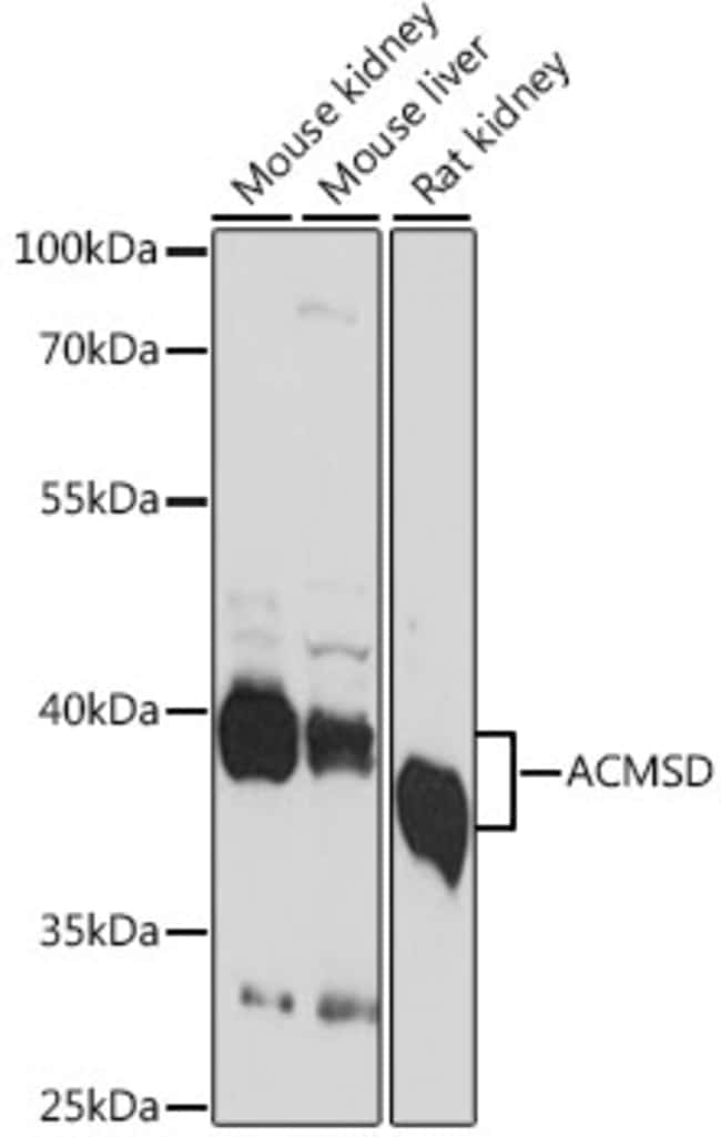 100UL ACMSD ANTIBODY 100 ul