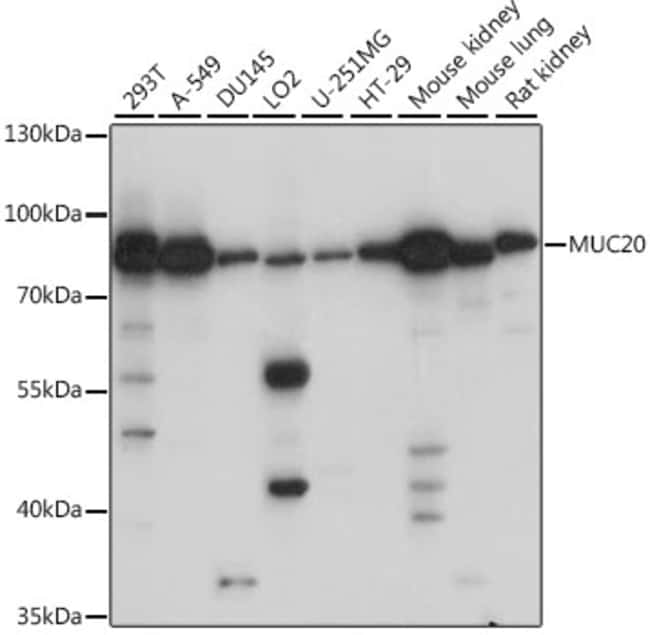 100UL MUC20 ANTIBODY 100 ul