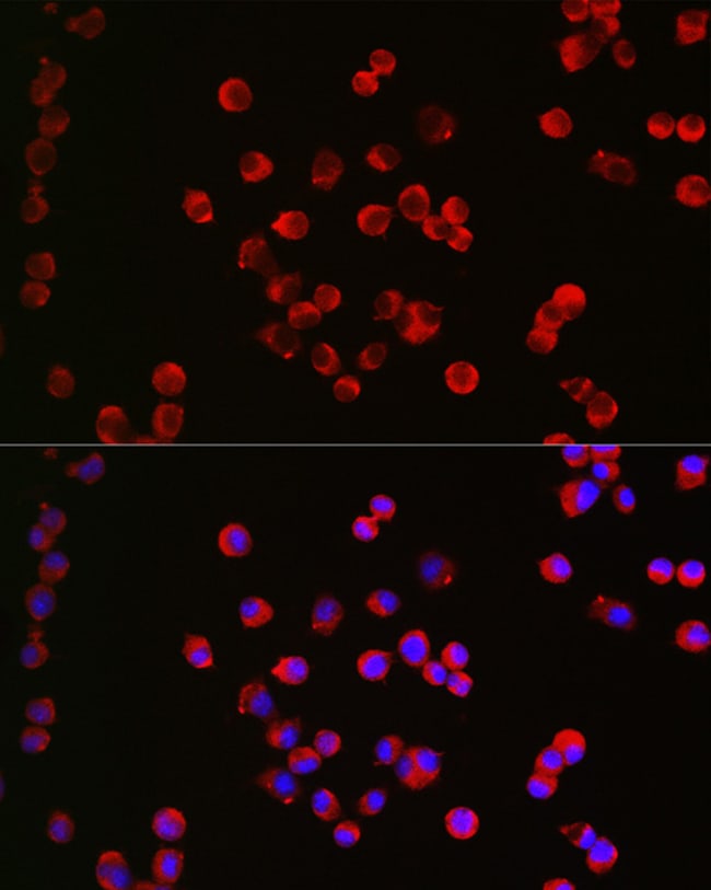 100UL CHRM1 ANTIBODY 100 ul