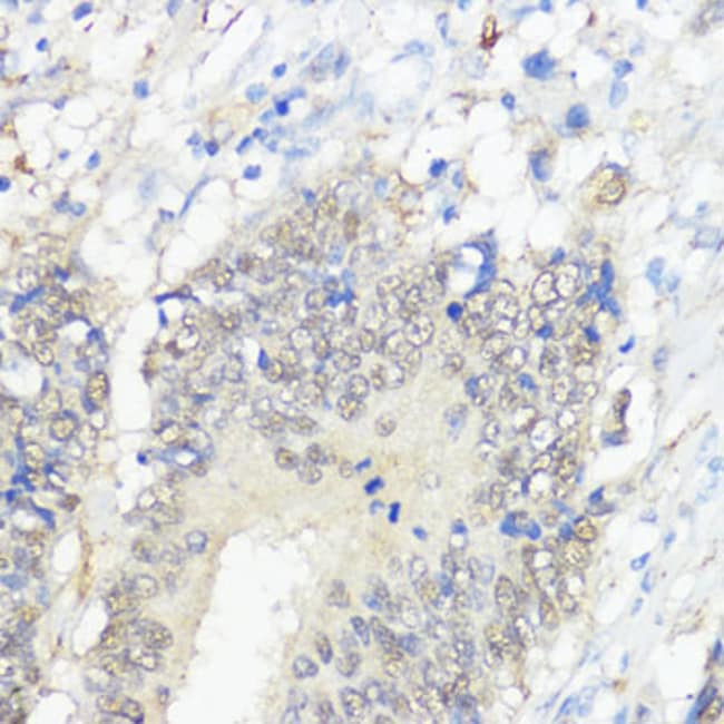 100UL GPX2 ANTIBODY 100 ul