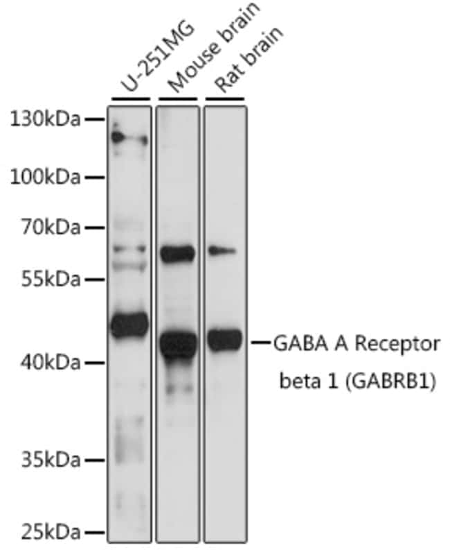 100UL GABRB1 ANTIBODY 100 ul