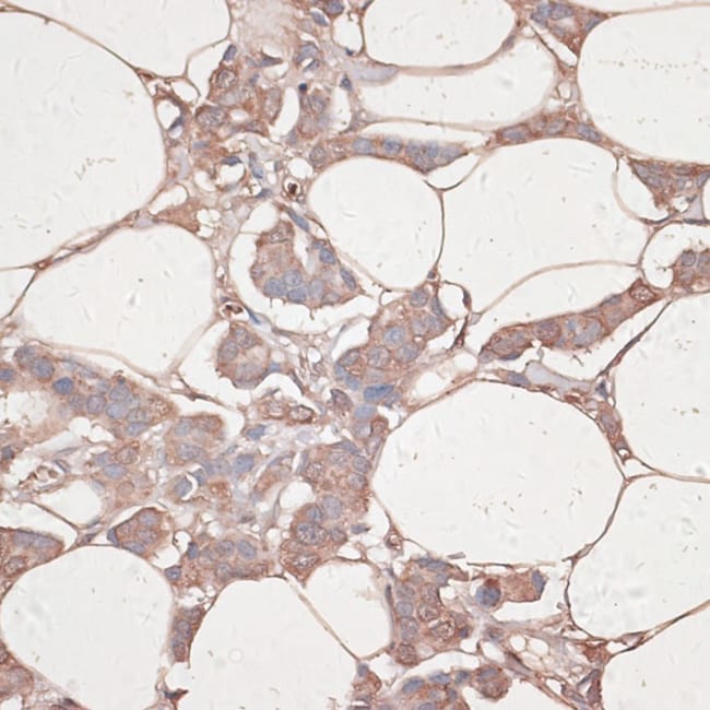 100UL LAMININ GAMMA-1 ANTIBODY 100 ul