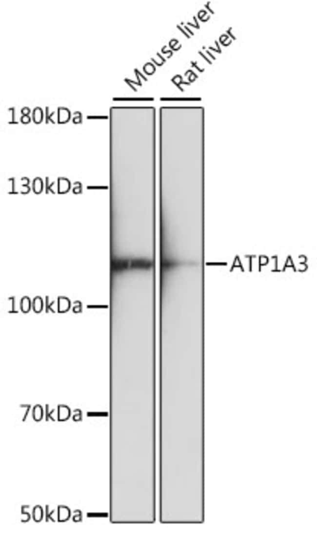 100UL ATP1A3 ANTIBODY 100 ul