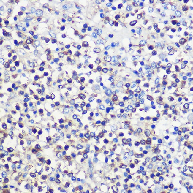 100UL CD80 ANTIBODY 100 ul