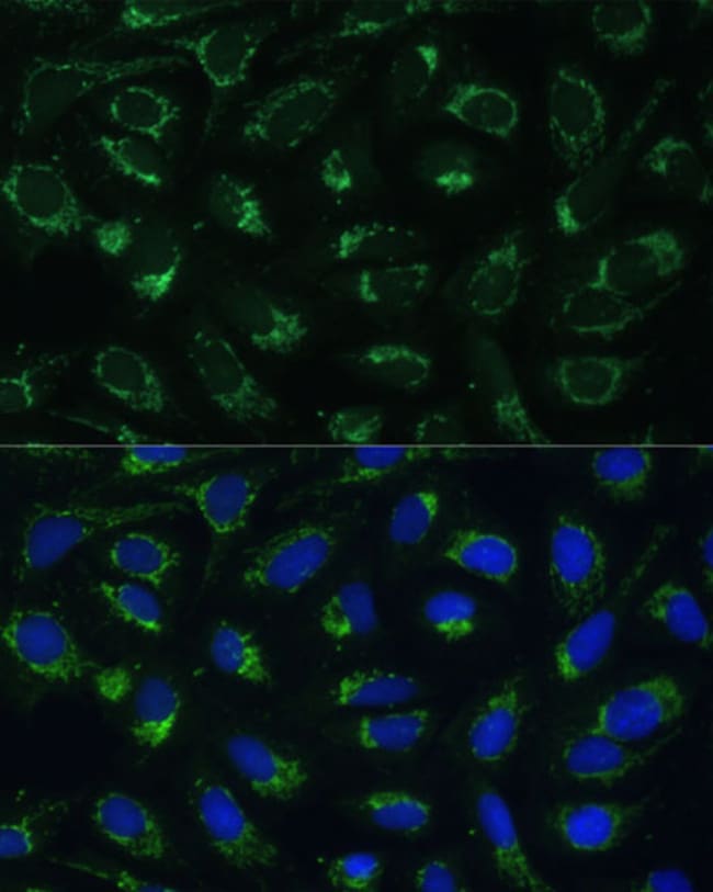 100UL ETFB ANTIBODY 100 ul