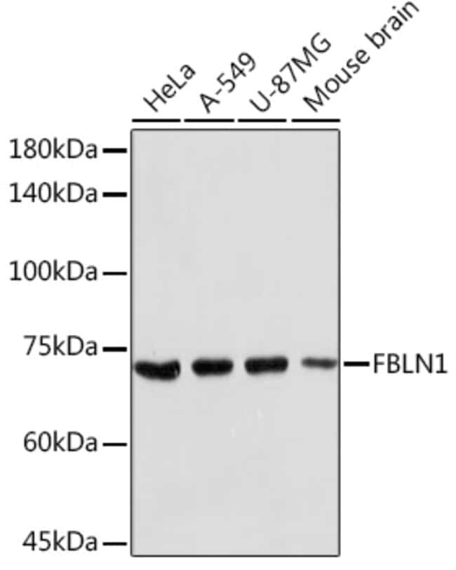 100UL FIBULIN 1 ANTIBODY 100 ul