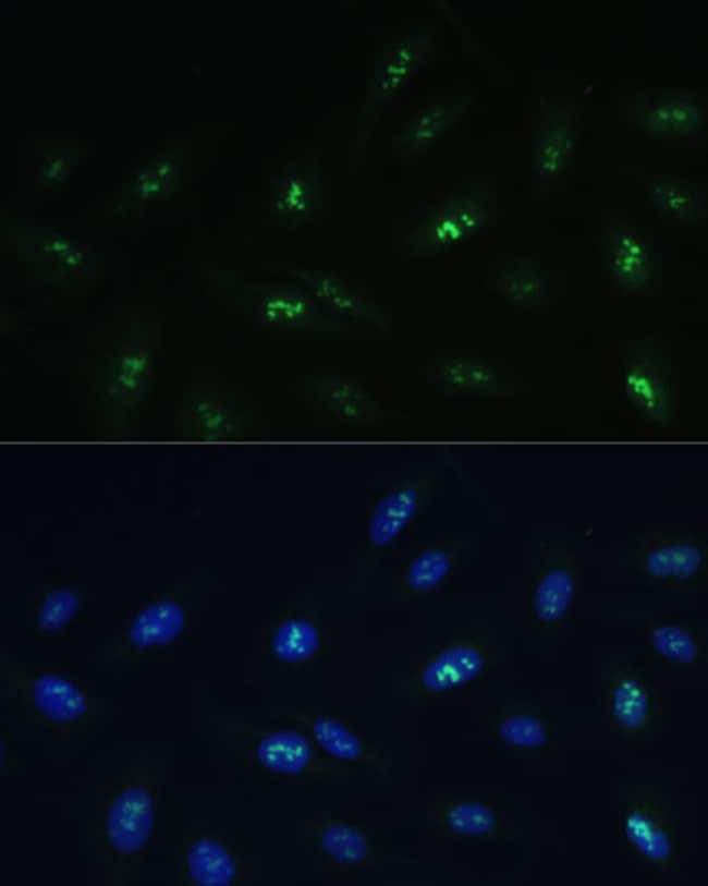 100UL HNF4G ANTIBODY 100 ul