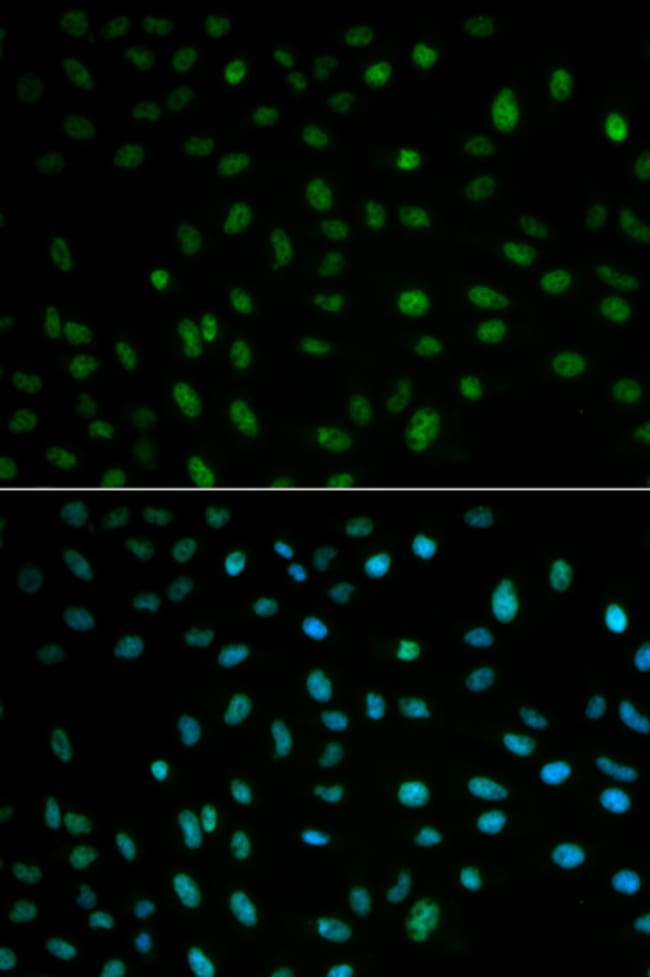 100UL HUR ANTIBODY 100 ul