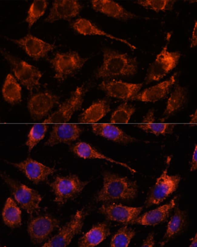100UL GPRASP1 ANTIBODY 100 ul