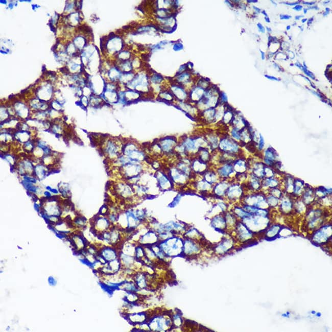 100UL EPSIN 2 ANTIBODY 100 ul