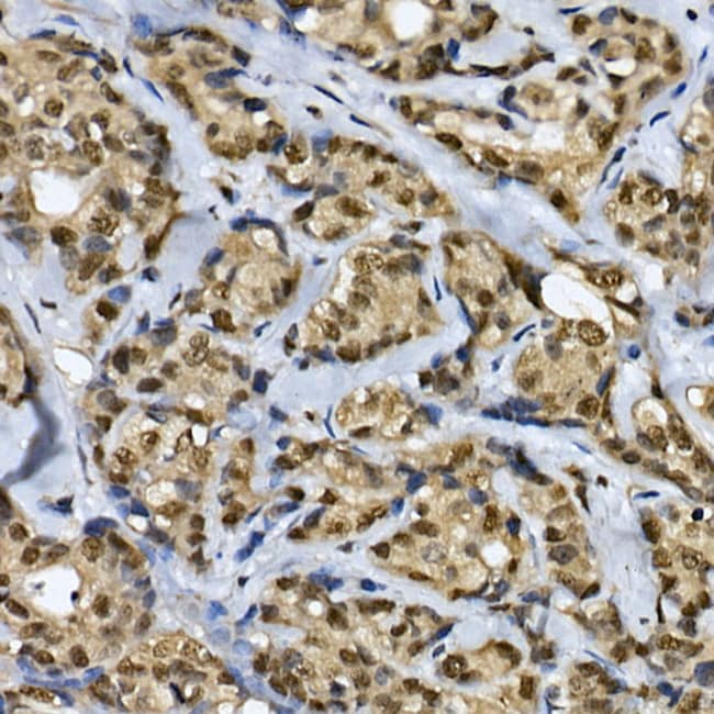 100UL CDC2L6 ANTIBODY 100 ul