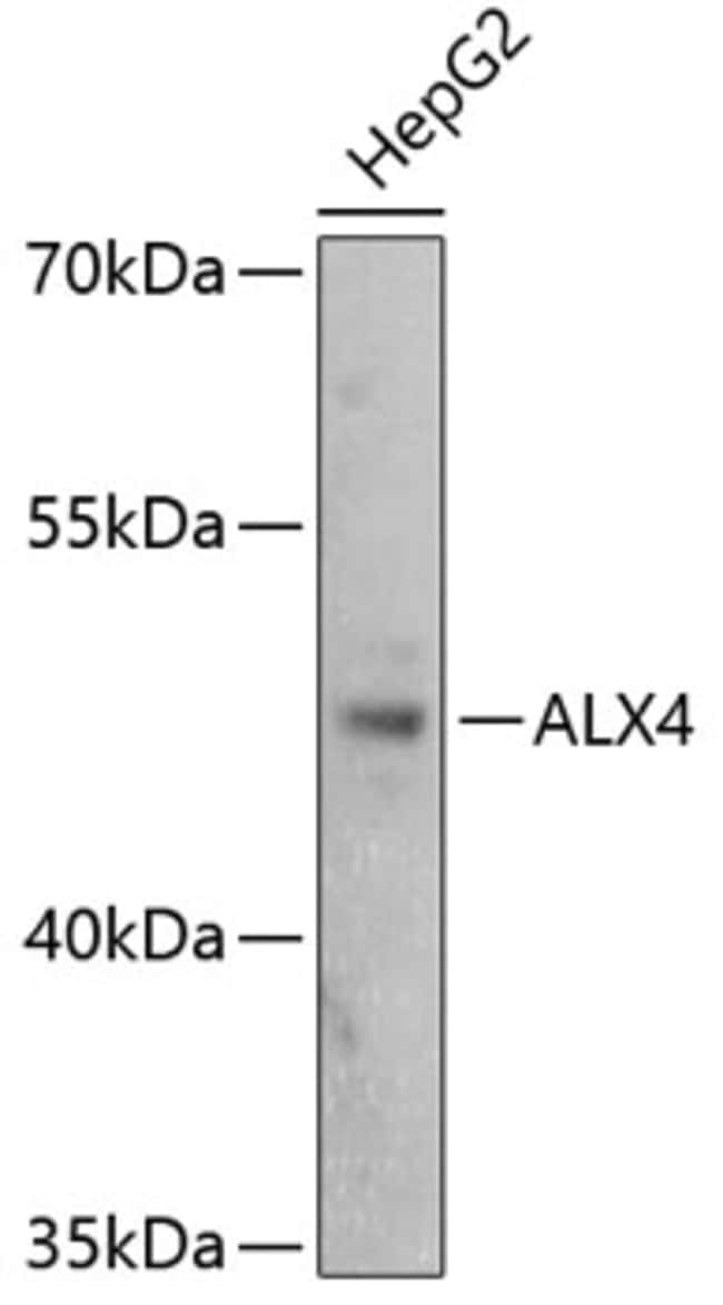 100UL ALX4 ANTIBODY 100 ul