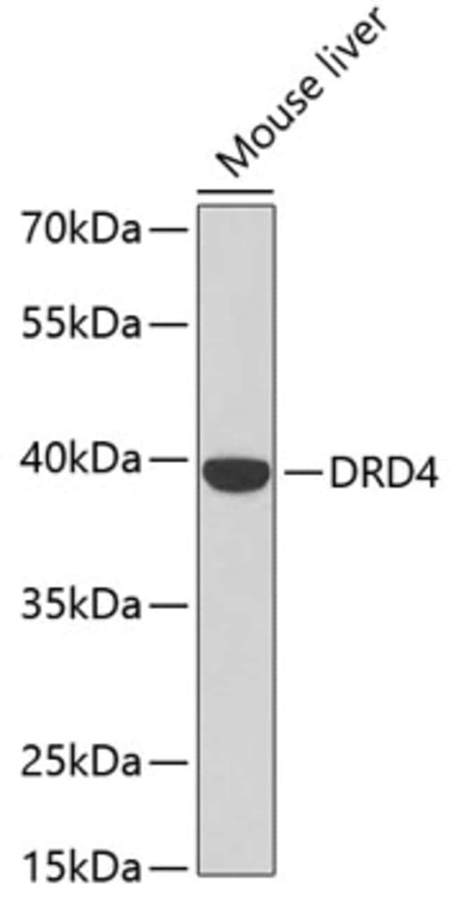 100UL D4 DOPAMINE RECEPTOR ANTIBODY 100