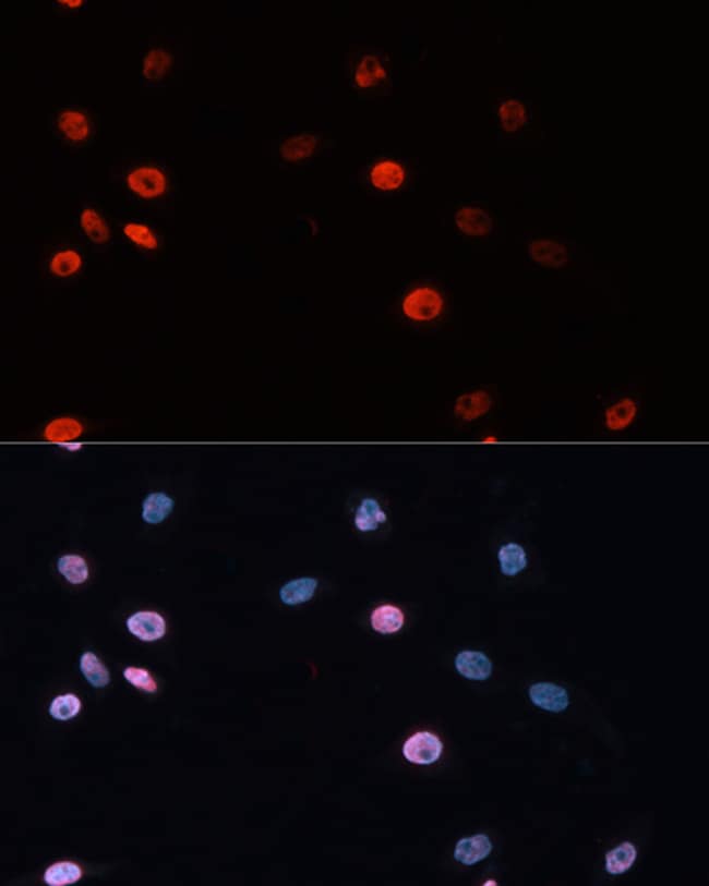 100UL DNMT3B ANTIBODY 100 ul
