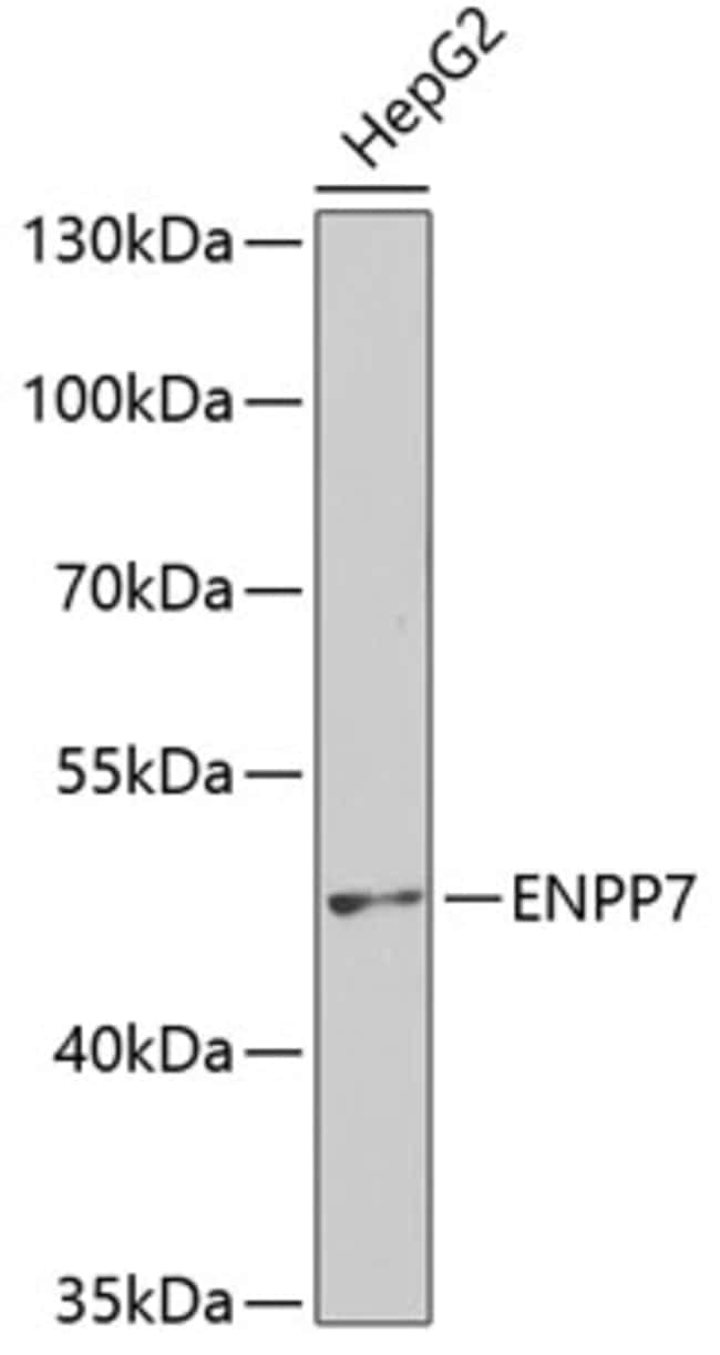 100UL ENPP7 ANTIBODY 100 ul