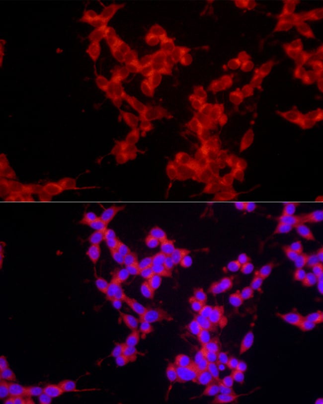100UL EPOR ANTIBODY 100 ul