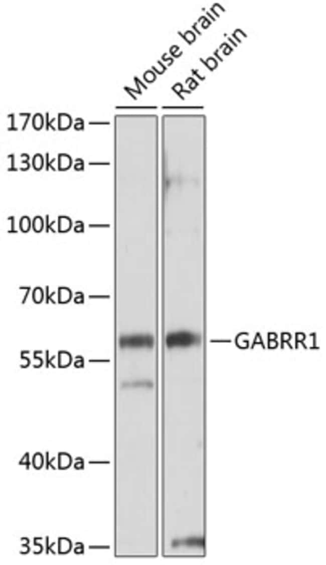 100UL GABRR1 ANTIBODY 100 ul