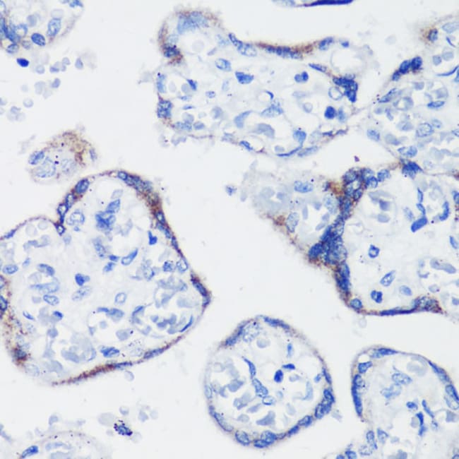 100UL KISS1 ANTIBODY 100 ul