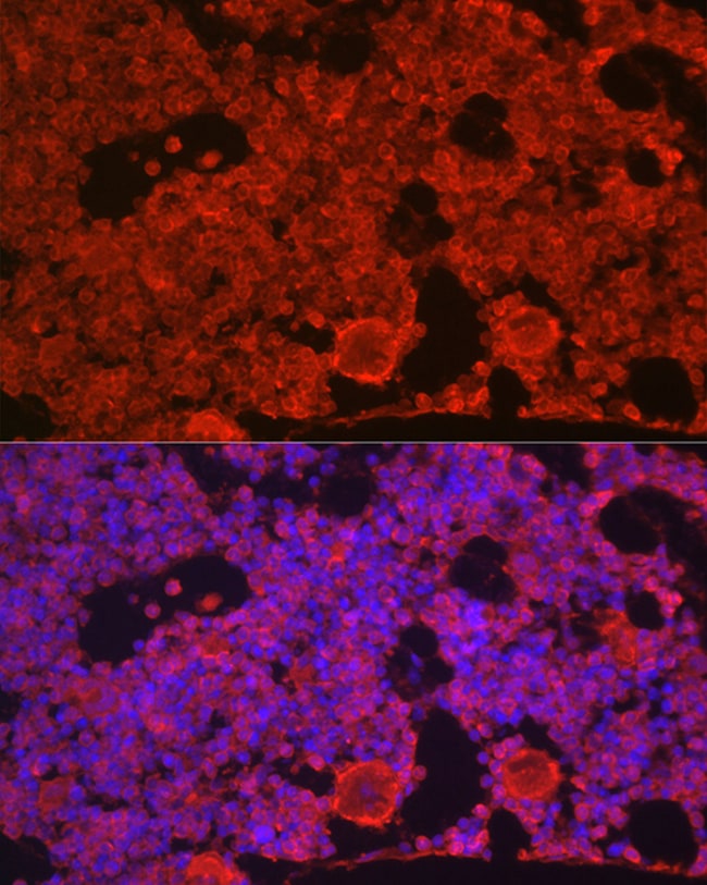 100UL CSF1R ANTIBODY 100 ul