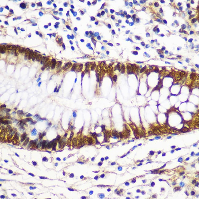 100UL 14-3-3 GAMMA ANTIBODY 100 ul
