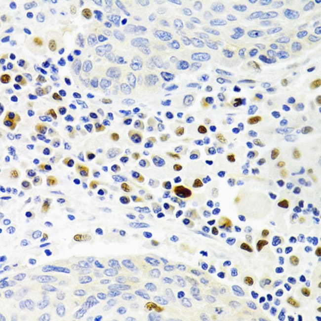 100UL GEMIN 2 ANTIBODY 100 ul