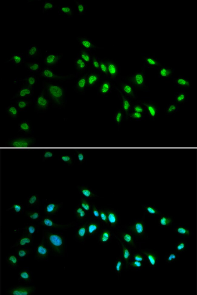 100UL DNMT3A ANTIBODY 100 ul
