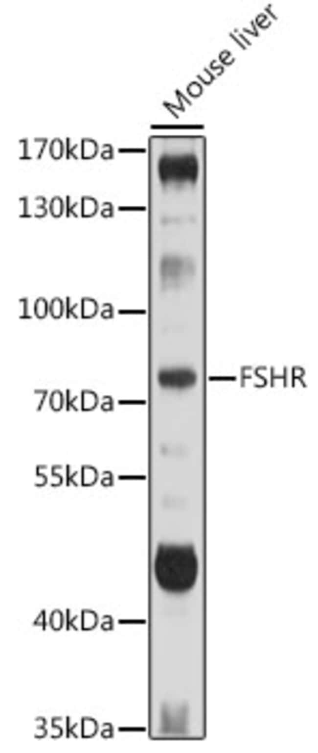 100UL FSHR ANTIBODY 100 ul