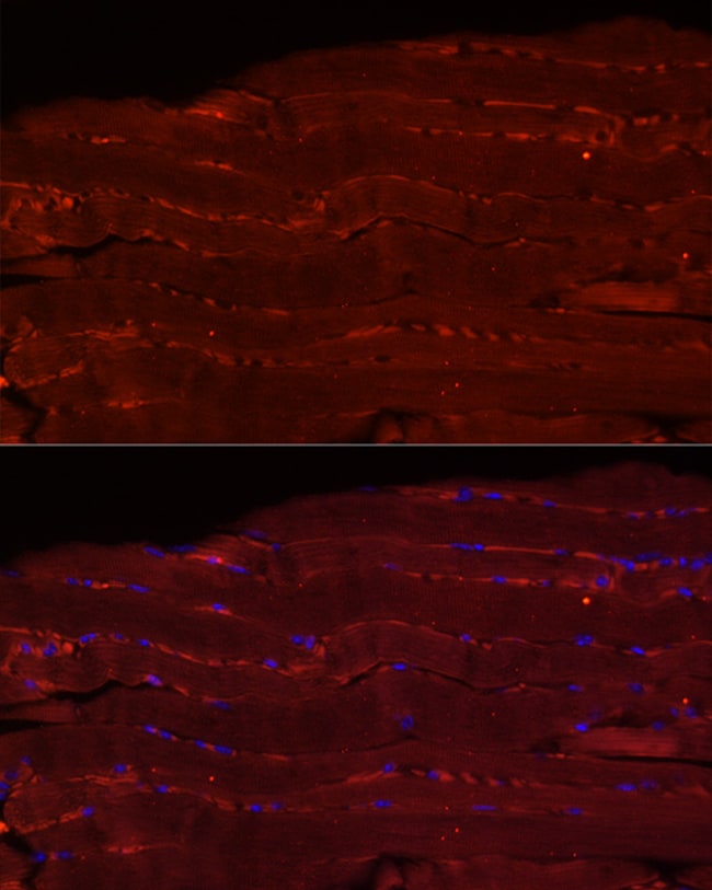 100UL FBXO32 ANTIBODY 100 ul