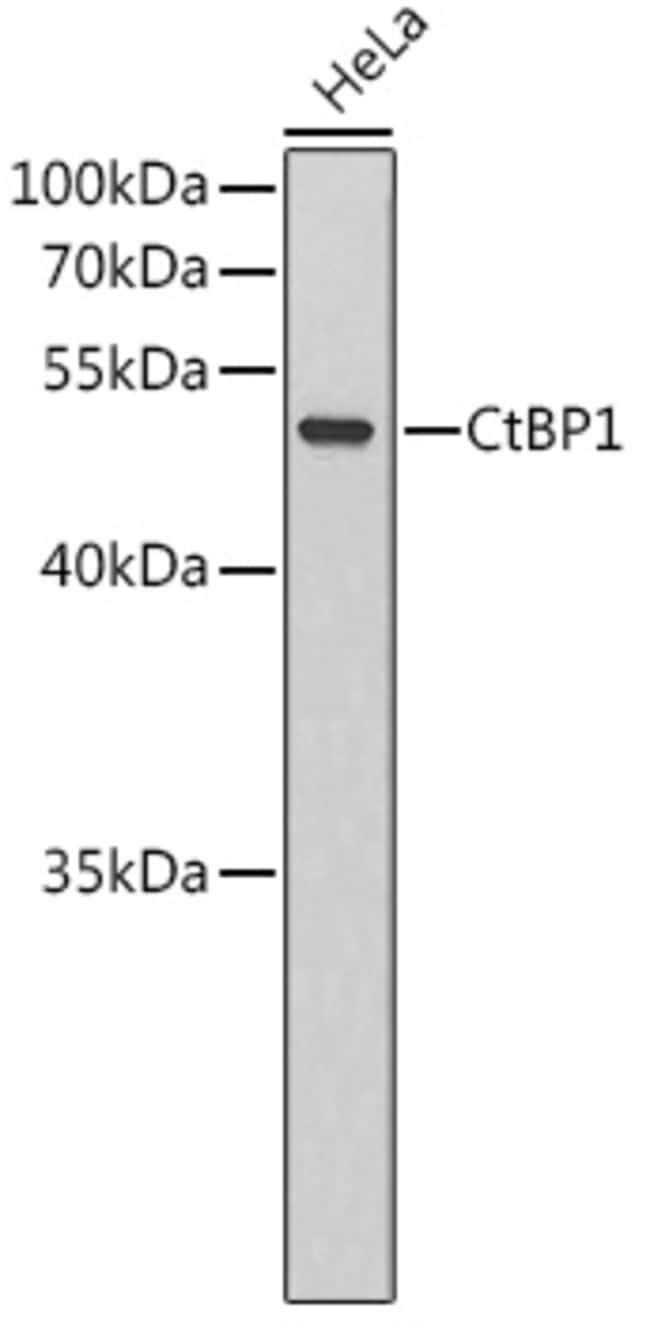 100UL CTBP1 ANTIBODY 100 ul