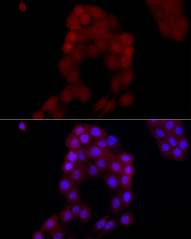 100UL AIM2 ANTIBODY 100 ul