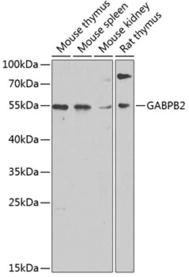 100UL GABPB2 ANTIBODY 100 ul
