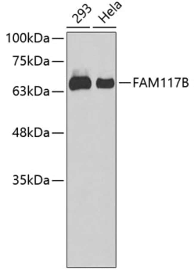100UL FAM117B ANTIBODY 100 ul