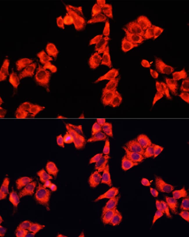 100UL ARHGAP5 ANTIBODY 100 ul