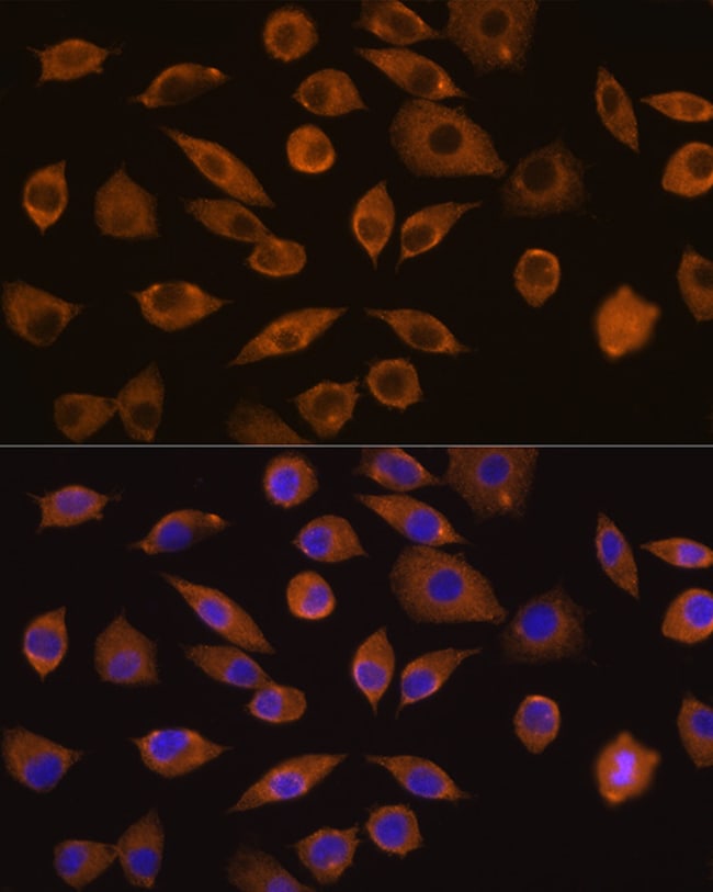 100UL DOCK2 ANTIBODY 100 ul
