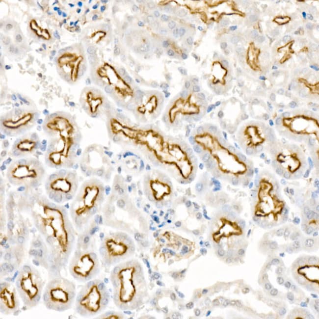 100UL LRP2 ANTIBODY 100 ul