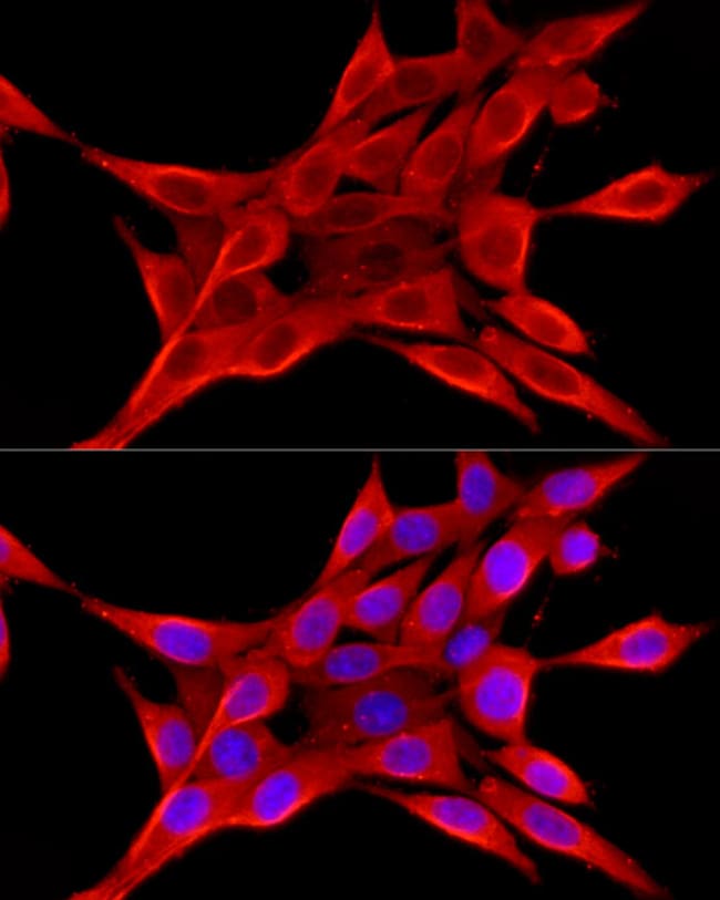 100UL ELOVL4 ANTIBODY 100 ul