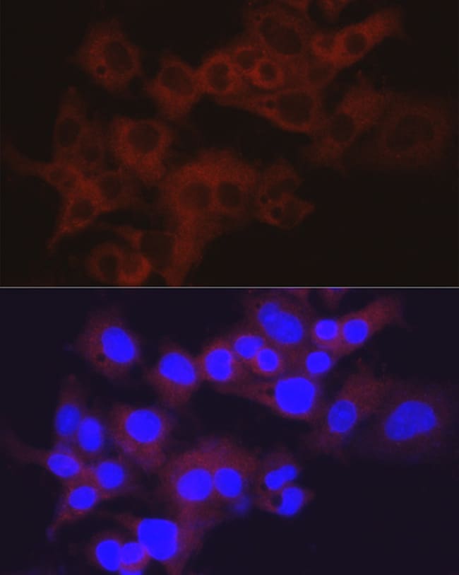 100UL ALDOLASE B ANTIBODY 100 ul