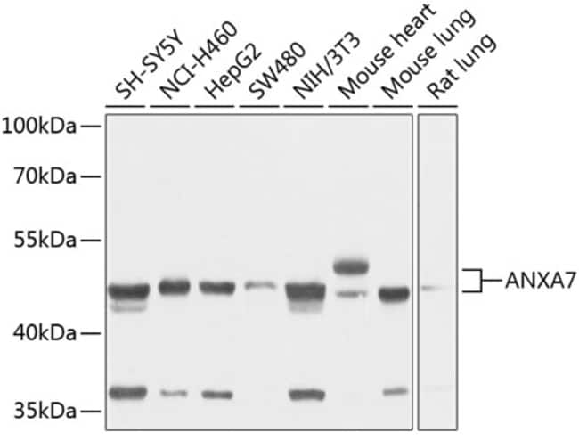 100UL ANNEXIN A7 ANTIBODY 100 ul