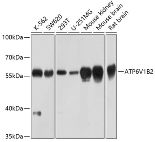 100UL ATP6V1B2 ANTIBODY 100 ul