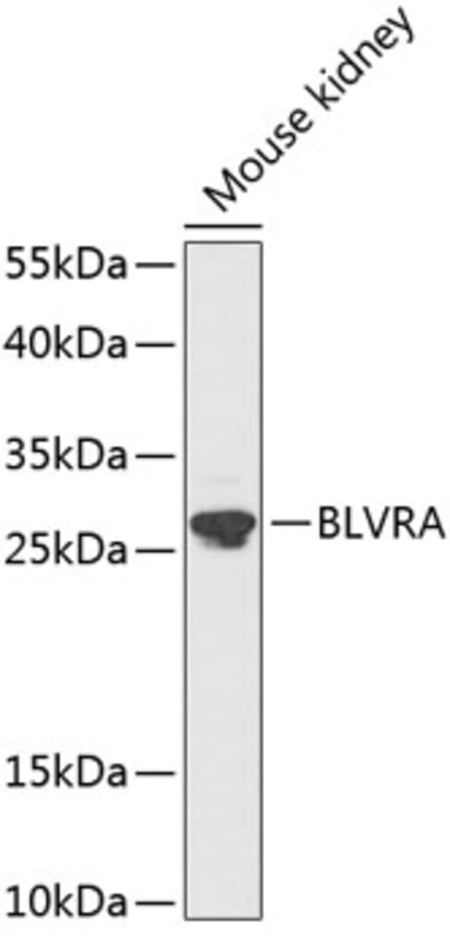 100UL BILIVERDIN REDUCTASE ANTIBODY 100